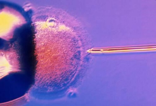 试管婴儿之胚胎不发育，原来是这些原因，天呐！